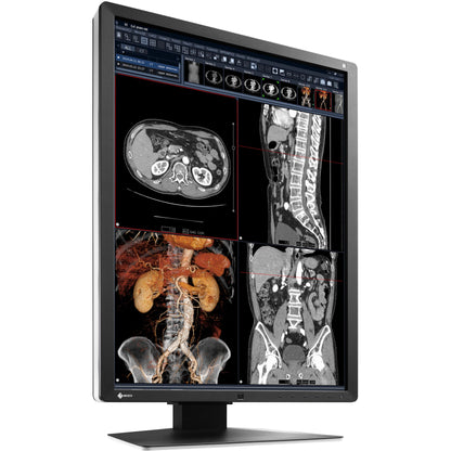 EIZO RadiForce RX250 21.3" LCD Monitor - 3:4 - Black