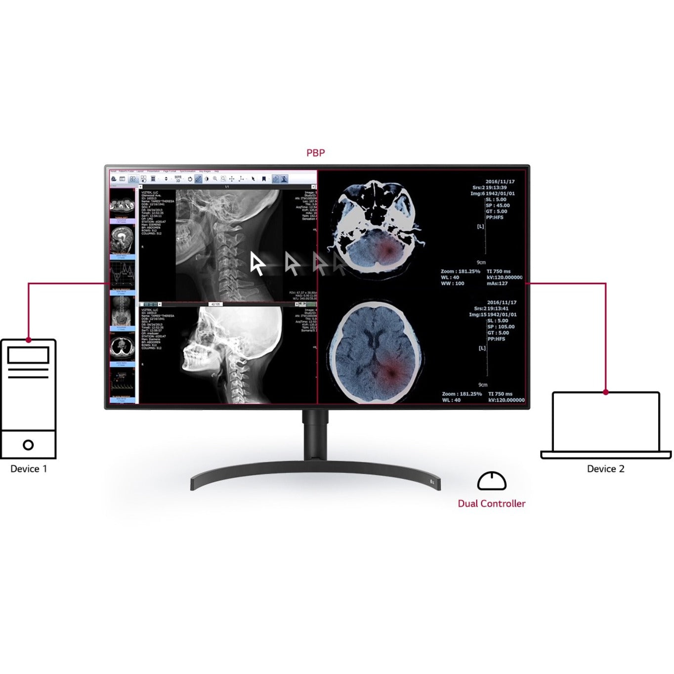 LG 32HL512D-B 31.5" 4K LCD Monitor - 16:9 - TAA Compliant