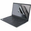 StarTech.com 15.6-inch 16:9 Laptop Privacy Filter Anti-Glare Privacy Screen w/51% Blue Light Reduction +/- 30&deg; View Angle Matte/Glossy